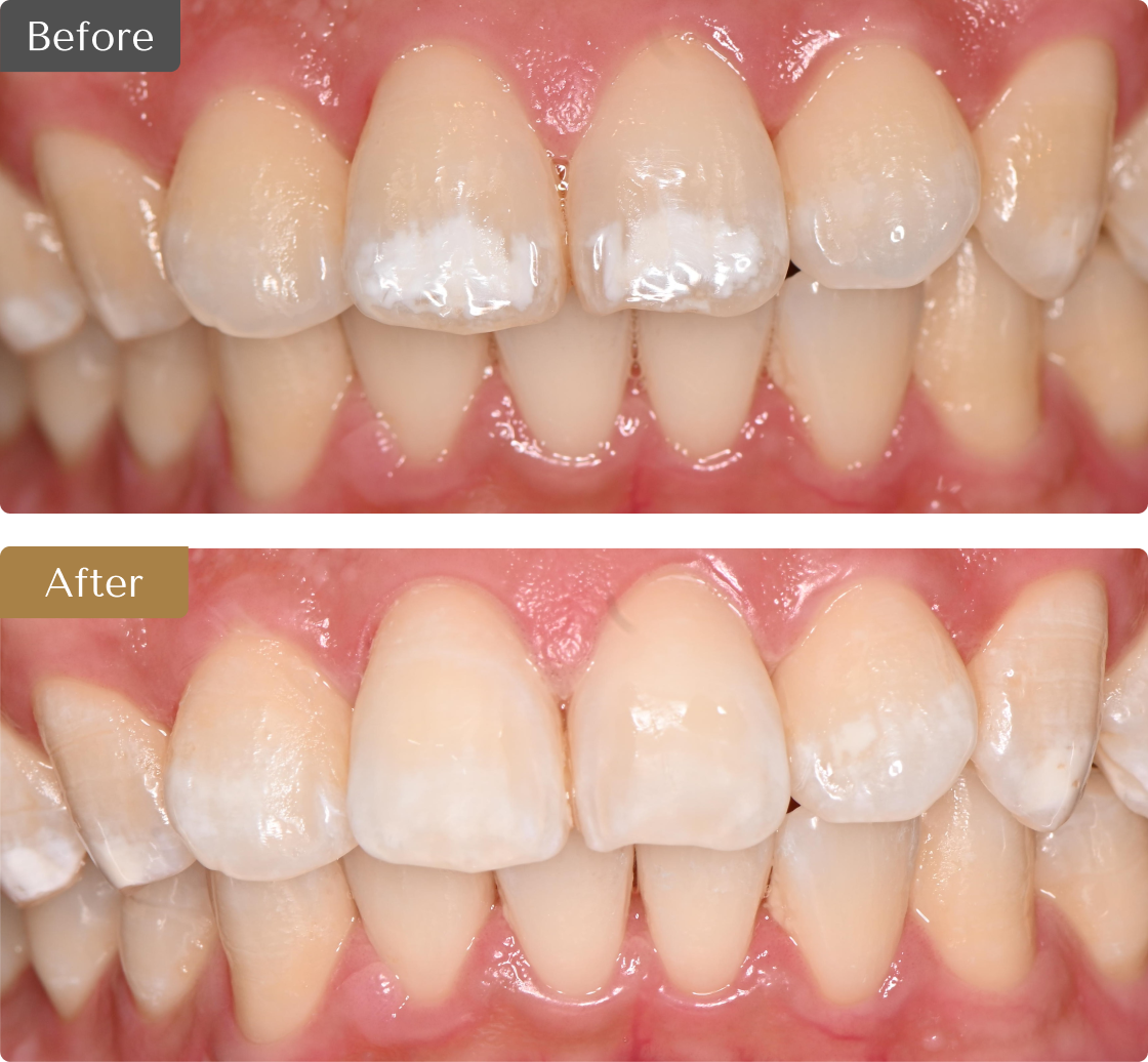 治療症例のビフォーアフターの画像