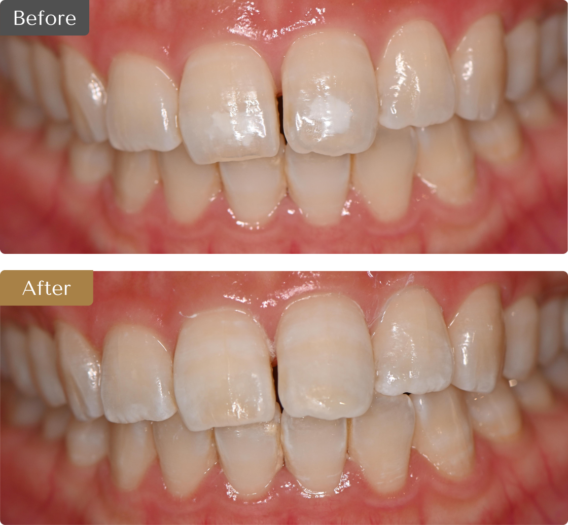 治療症例のビフォーアフターの画像