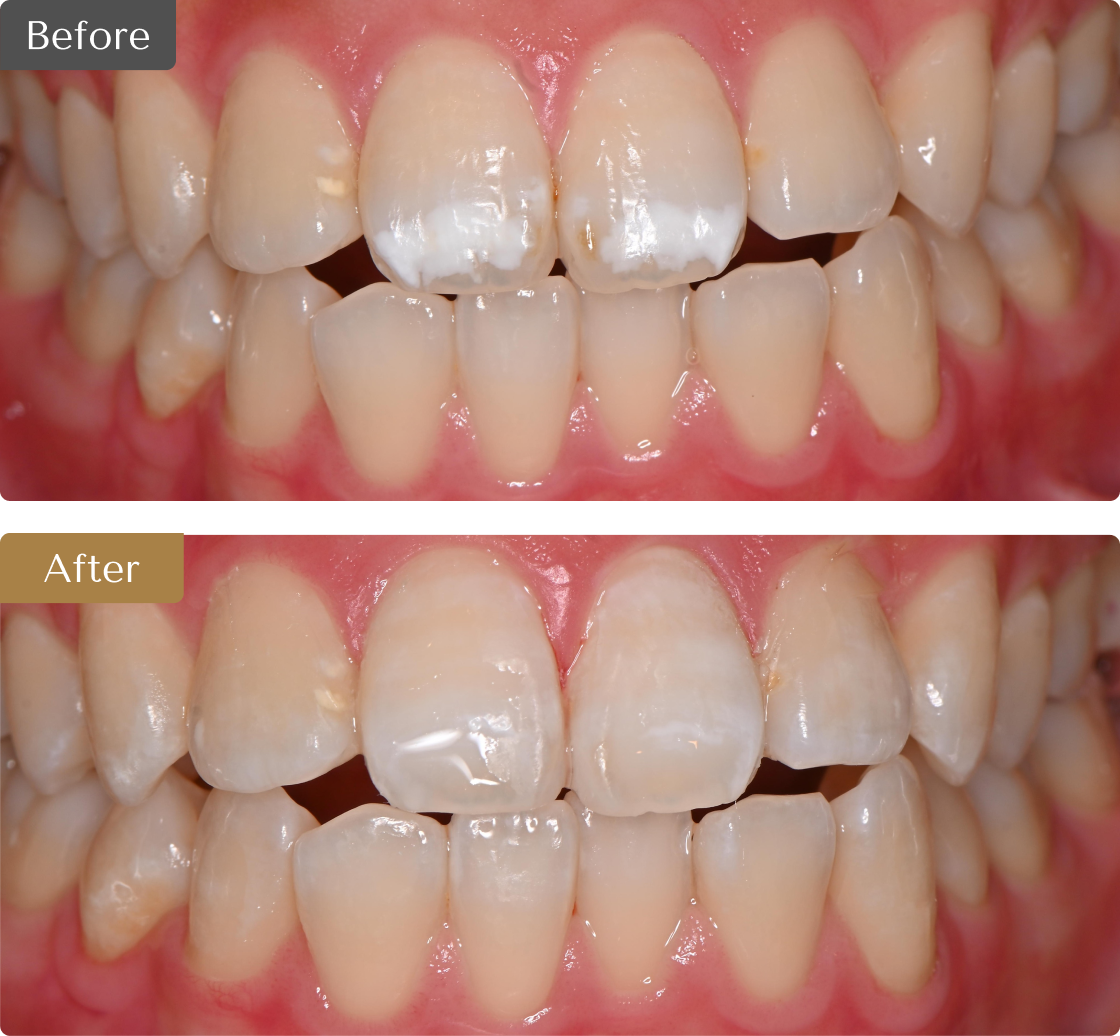 治療症例のビフォーアフターの画像